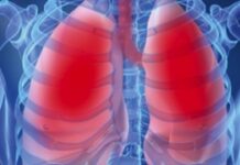 Un nou simptom al infecției cu coronavirus, descoperit de cercetători